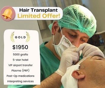 5000 grafts hair transplant in Turkey package