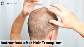 Tips and Instructions after Hair Transplant
