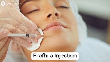 Profhilo Injections