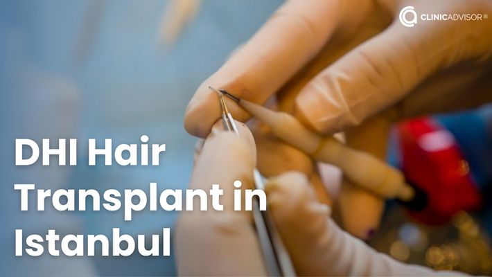 Get Your Hair Transplant Done in Istanbul, Turkey Using DHI Technique