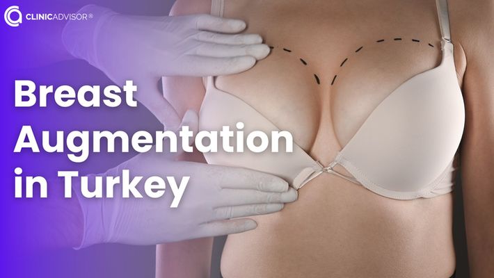 Breast Augmentation in Turkey: Safe, Affordable and Expert Surgeons