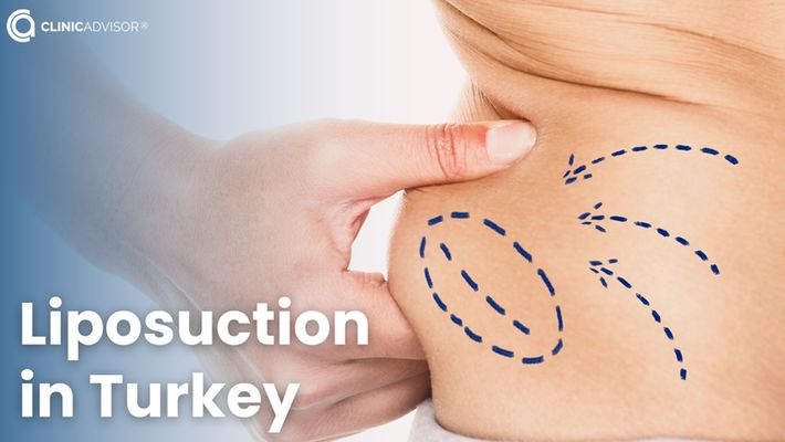 Liposuction in Turkey: Get the Contoured Body of Your Dreams with Our Expert Surgeons