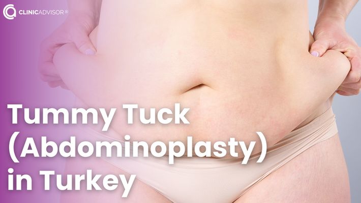 Tummy Tuck (Abdominoplasty) in Turkey with Expert Surgeons