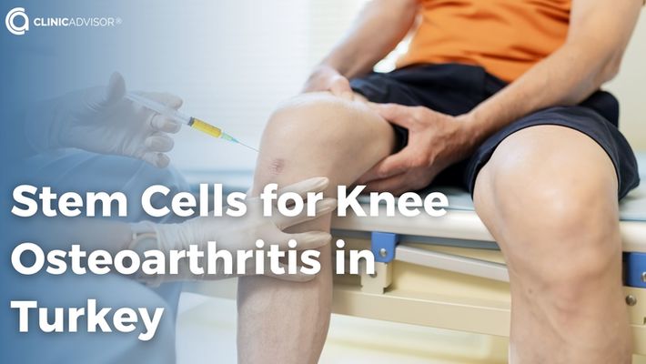 Stem Cells for Osteoarthritis of the Knee