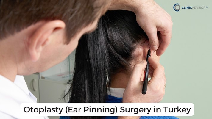 Otoplasty (Ear Pinning) Surgery in Turkey