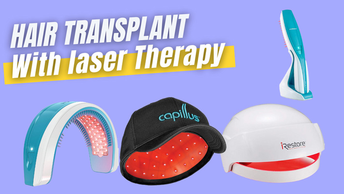 Does Hair Transplant with Laser Therapy Really Work?