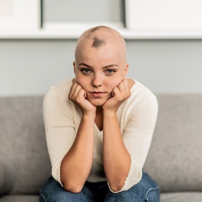 Alopecia Areata Symptoms : What are they?