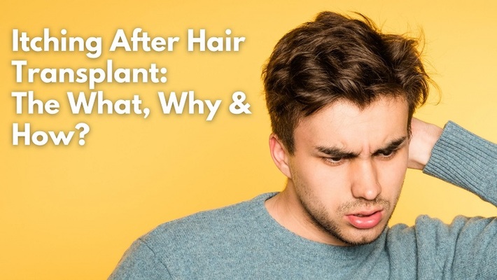 Feel Itching After Hair Transplant? Here is the Reason Why