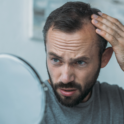 Hair Loss in Men: Treatments and Prevention