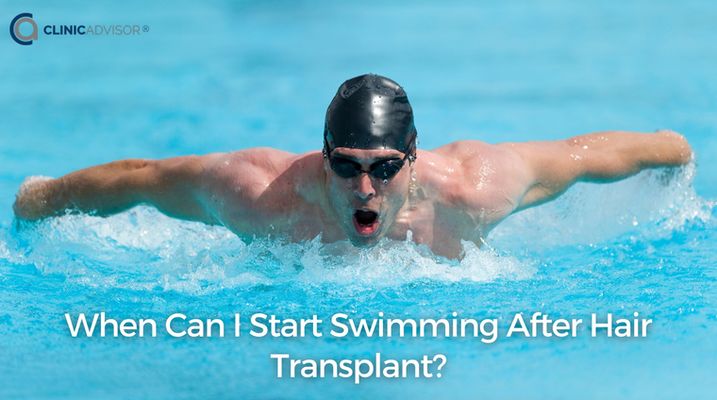 When Can I Start Swimming after Hair Transplant?