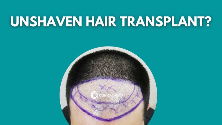 Unshaven Hair Transplant