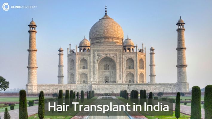 Hair Transplant in India: The Cost and Important Facts