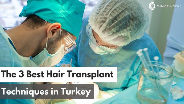 The Best Hair Transplant Techniques in Turkey