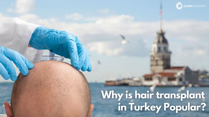 Why is Turkey Popular for Hair Transplant?