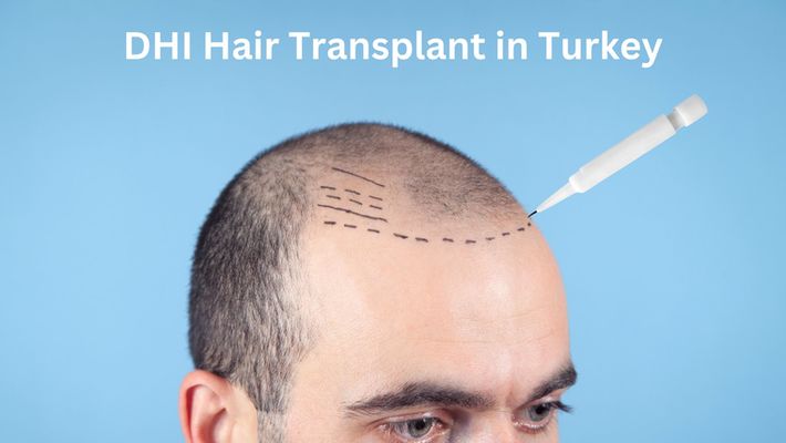 DHI Hair Transplant in Turkey