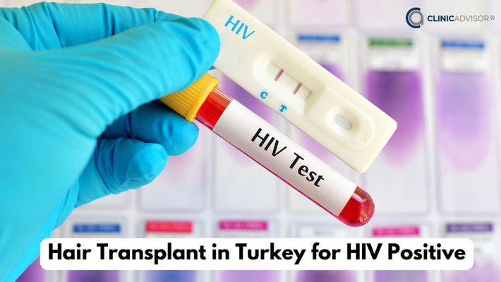 Is it Possible to Get a Hair Transplant in Turkey for HIV Positive Patients?