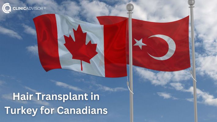 Hair Transplant in Turkey for Canadians
