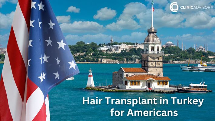 Hair Transplant in Turkey for Americans