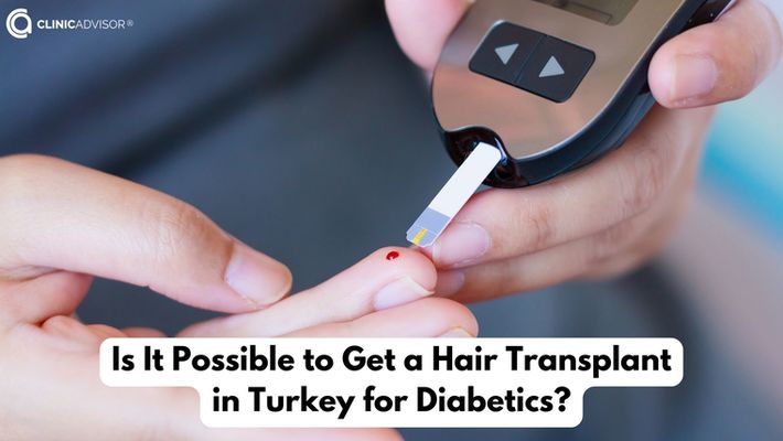 Is Hair Transplant in Turkey for Diabetics Possible?