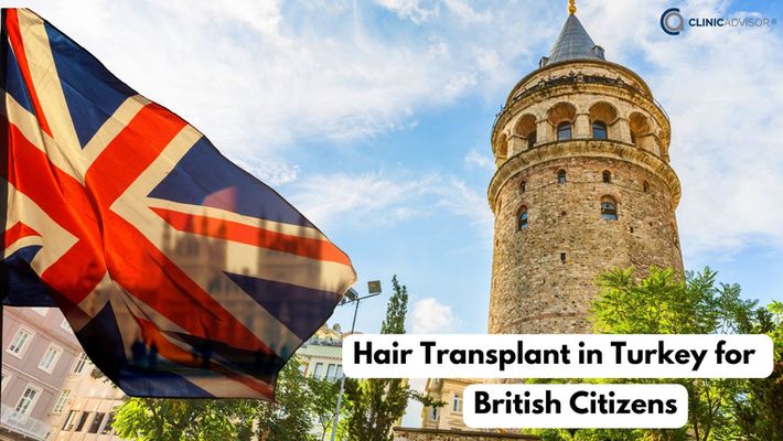 Hair Transplant in Turkey for British Citizens