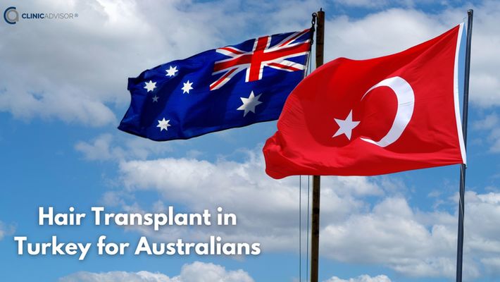 Hair Transplant in Turkey for Australians