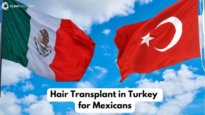 Hair Transplant in Turkey for Mexicans