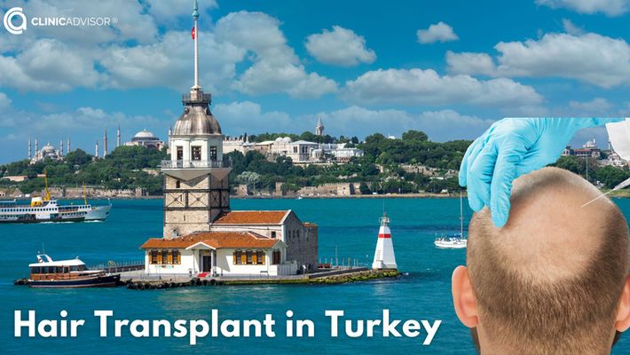 Hair Transplant in Turkey with ClinicAdvisor®