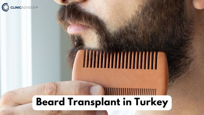 Beard hair transplant in Turkey