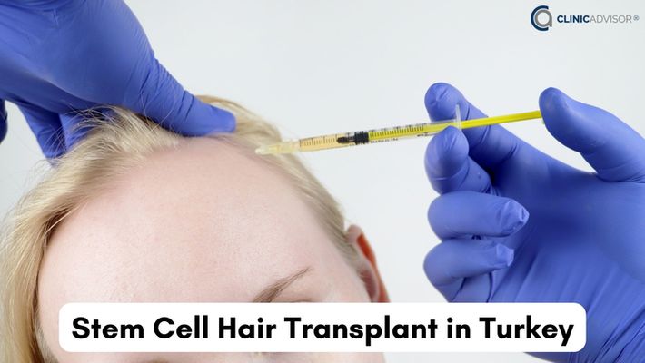 Stem Cell Hair Transplant in Turkey