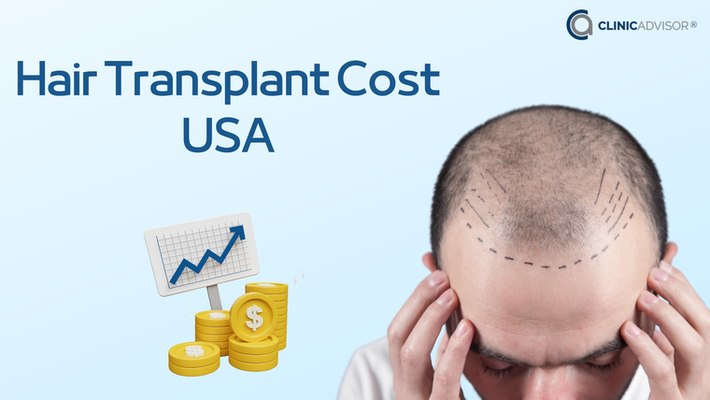 Hair Transplant Cost USA
