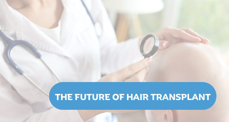 The Future of Hair Transplants