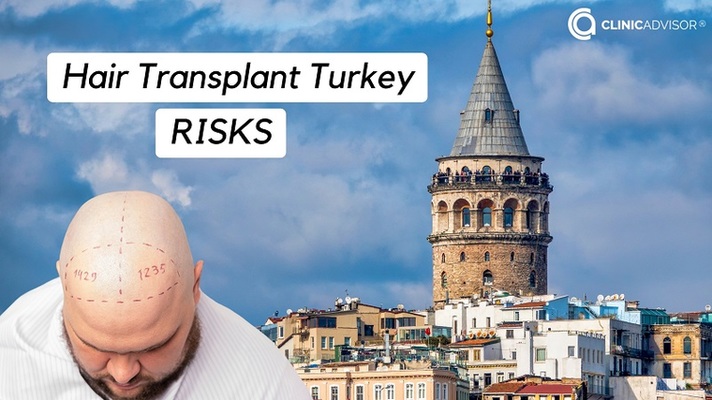 Hair Transplant Turkey Risks