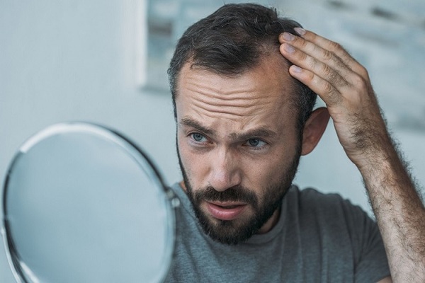 Is It Normal to Have Pimples After Hair Transplant?