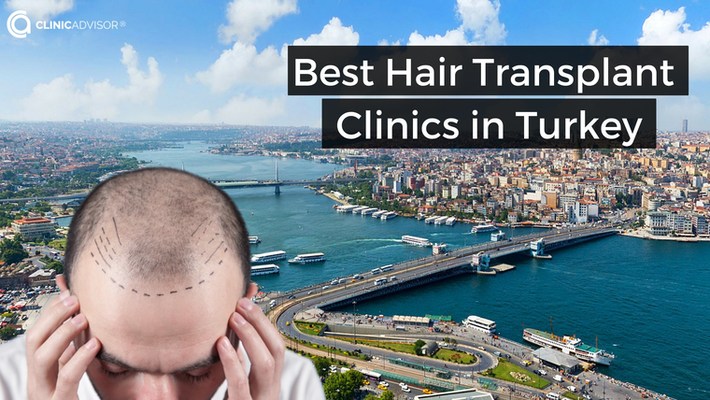 7 Best Hair Transplant in Turkey for 2024: Price, Results and Recommendations